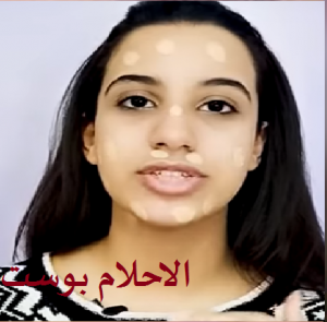 توزيع الفاونديشن