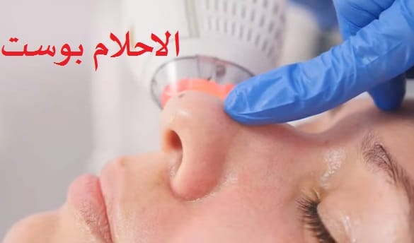 اسباب وعلاج وأنواع حب الشباب