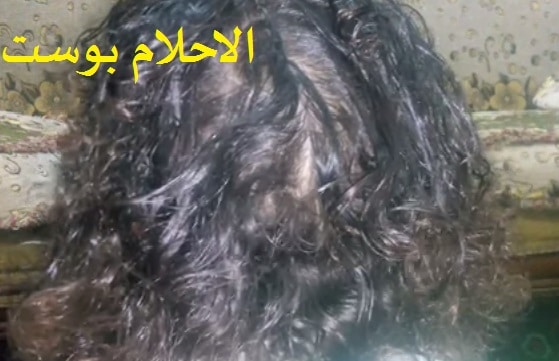 فوائد العسل للشعر و مشاكل الشعر