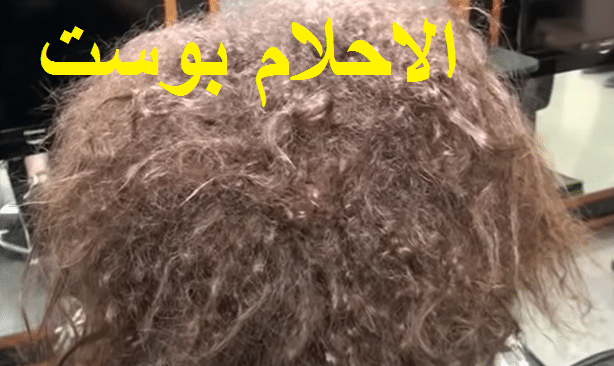 بروتين الشعر المعالج واستخدامه