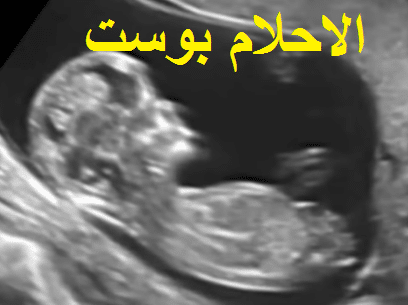 مراحل تكوين الجنين 