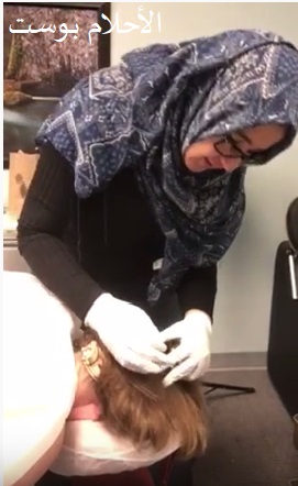 الحجامة وفوائدها 
