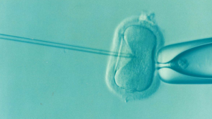 ICSI intracytoplasmic sperm injection