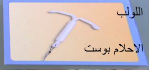 اللولب