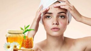 اسباب ظهور حبوب حمراء في الوجه