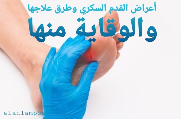 القدم السكري