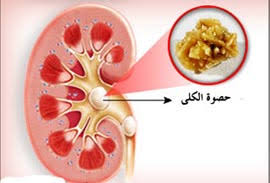 حبوب تامسولوسين