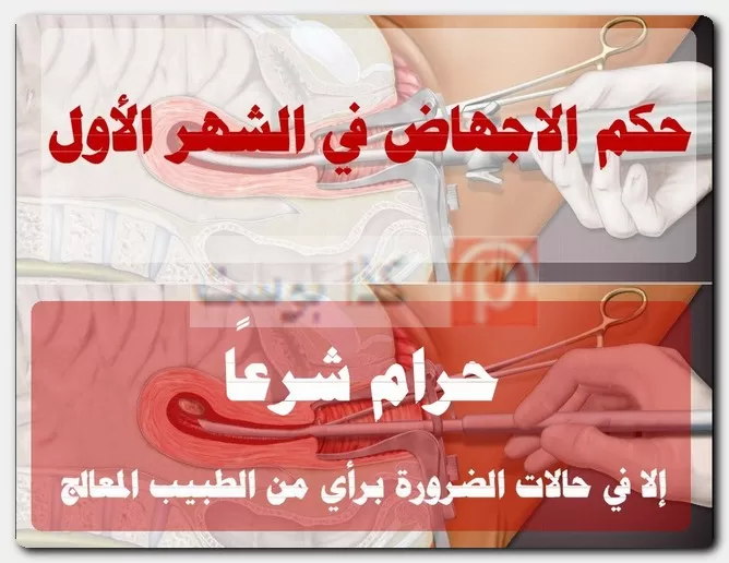 الإجهاض في الشهر الأول