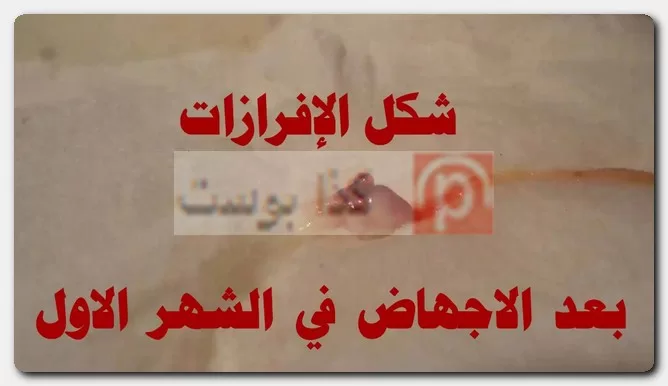 الإجهاض في الشهر الأول