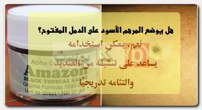المرهم الأسود