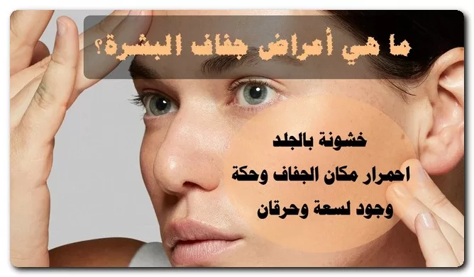 علاج جفاف البشرة في الشتاء