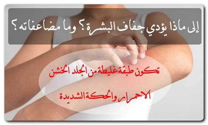 علاج جفاف البشرة في الشتاء
