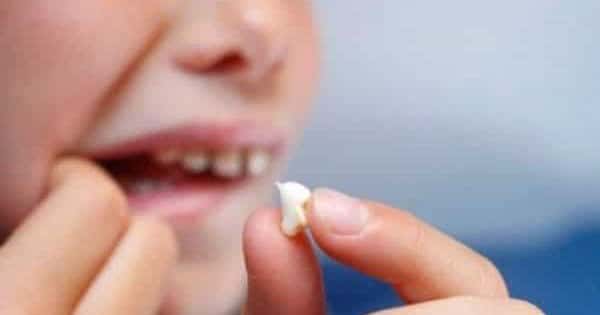 تفسير حلم وقوع الاسنان