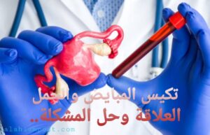 تكيس المبايض والحمل