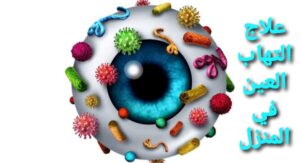 علاج التهاب العين في المنزل