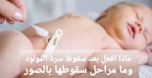 سرة المولود