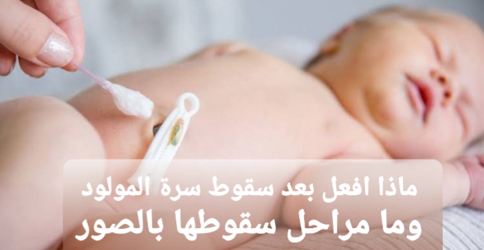 سرة المولود