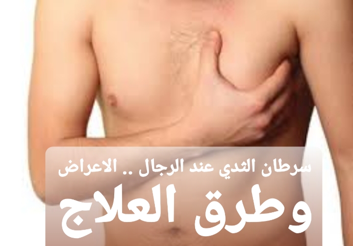 سرطان الثدي عند الرجال