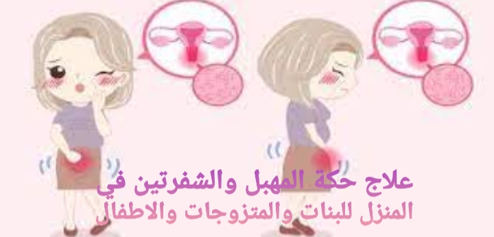 علاج حكة المهبل والشفرتين