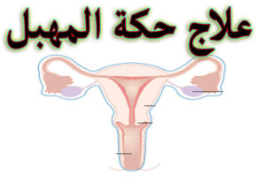 علاج حكة المهبل