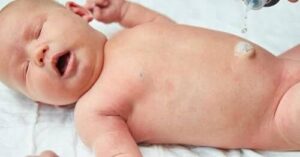 الورم الحبيبي