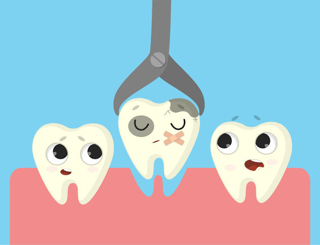 مراحل خلع ضرس العقل