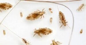 تفسير رؤية القمل في الحلم للحامل