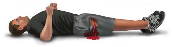 رؤيا الدم في المنام للنابلسي