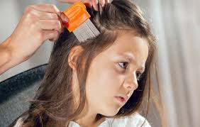 القمل في المنام