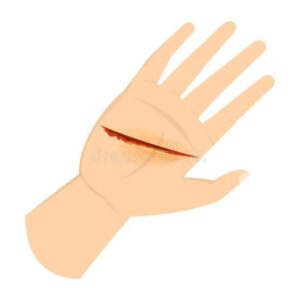 رؤية الدم للمتزوجة في المنام